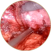 Uropro